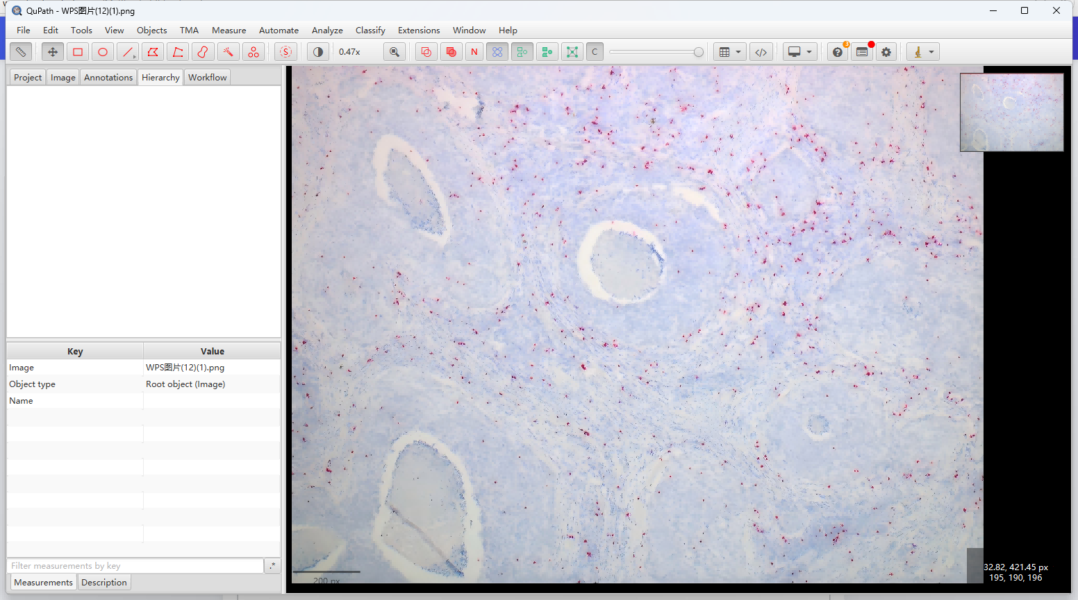 Qupath中实现细胞Fastred信号共定位检测
